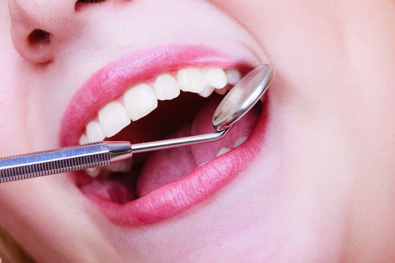 歯周病は成人が歯を失う最大の原因です